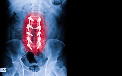 Common spine conditions and disorders treated by spine specialists