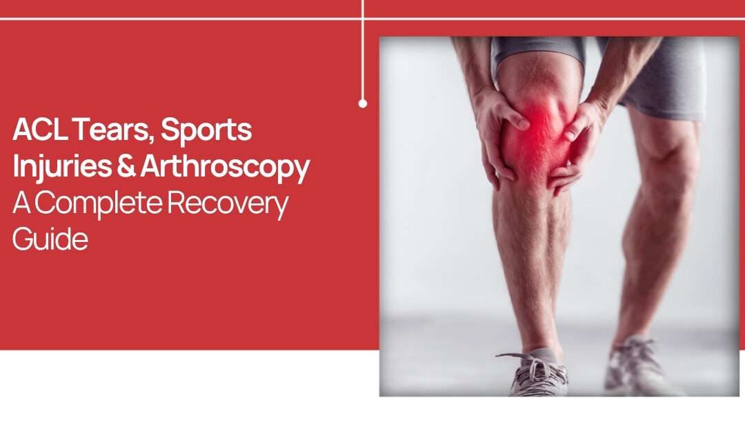 ACL Tears, Sports Injuries & Arthroscopy: A Complete Recovery Guide