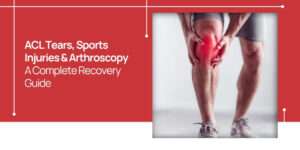 ACL Tears, Sports Injuries & Arthroscopy: A Complete Recovery Guide