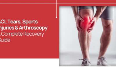 ACL Tears, Sports Injuries & Arthroscopy: A Complete Recovery Guide
