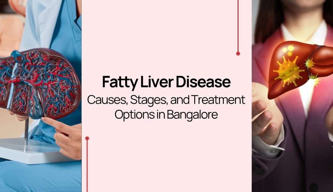 Fatty Liver Disease: Causes, Stages, and Treatment Options in Bangalore