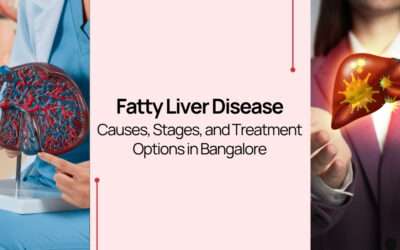 Fatty Liver Disease: Causes, Stages, and Treatment Options in Bangalore