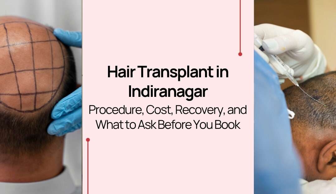 Hair Transplant in Indiranagar: Procedure, Cost, Recovery, and What to Ask Before You Book